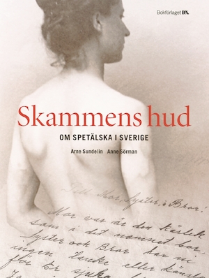Skammens hud : om spetälska i Sverige / Arne Sundelin, Anne Sörman