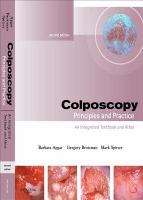 Colposcopy, principles and practice